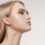 Face Lifting Threads Treatment: What It Is, How It Works & Who It's For