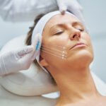 5 Signs You Might Need a Thread Lift Instead of Surgery