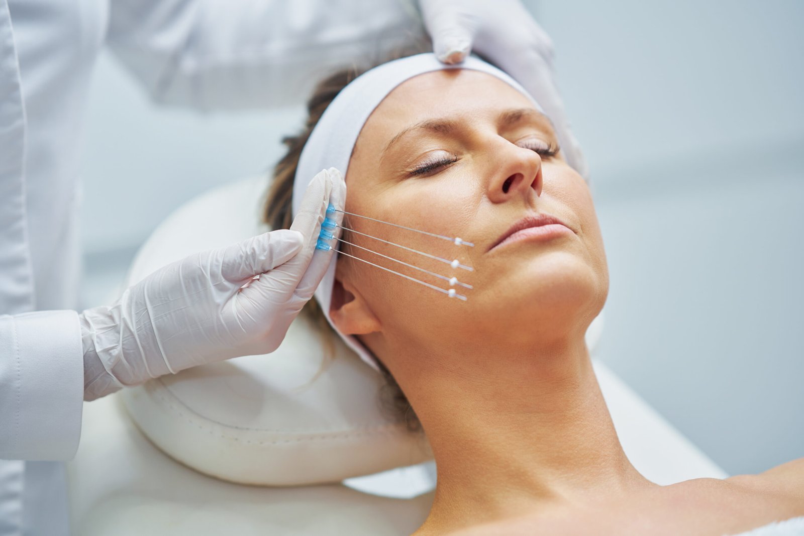 5 Signs You Might Need a Thread Lift Instead of Surgery